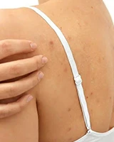 product-160-200
